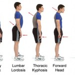 posture correction