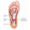 Treating Plantar Fasciitis (With a High Load Strength Training Program)